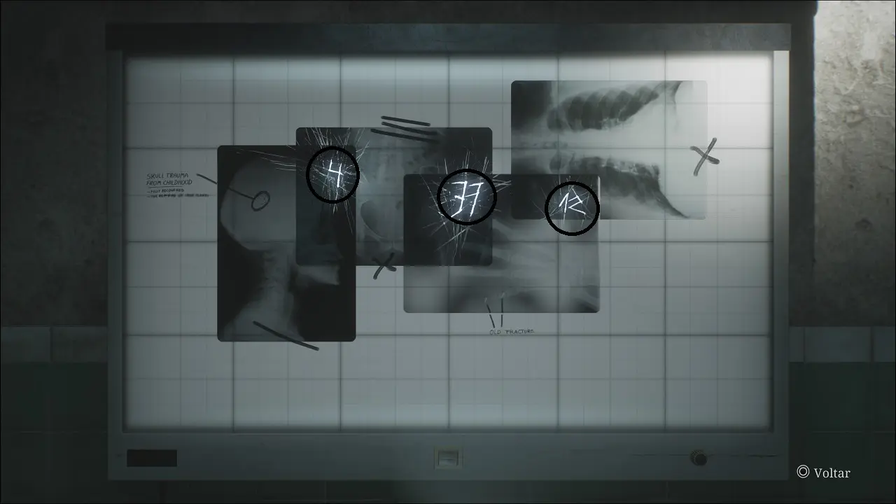 SILENT HILL 2 REMAKE - QUEBRA-CABEÇA DO NEGATOSCÓPIO